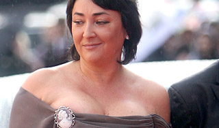 Лолита сделала пластическую операцию Изображение: Дни.ру