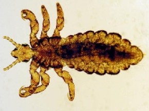 В Брянской области зарегистрировано 1212 случаев педикулёза