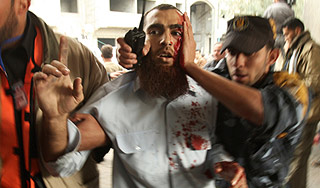 Египет примет раненых палестинцев Египет примет раненых палестинцев