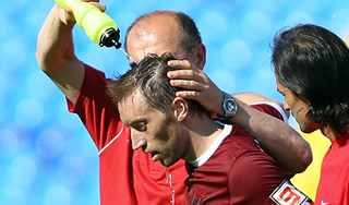 Футболист Быстров остается в коме Футболист Быстров остается в коме