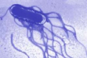 В "Синезерках" из-за вспышки сальмонеллеза отменили третью смену Кишечная инфекция - Сальмонеллёз