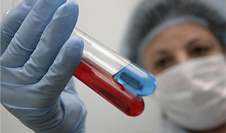 Ученые расшифровали код ВИЧ Ученые расшифровали код ВИЧ