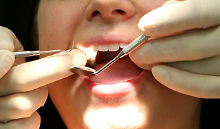 У девушки выросли 33 лишних зуба У девушки выросли 33 лишних зуба