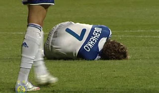 Андрею Шевченко наложили шесть швов Андрею Шевченко наложили шесть швов