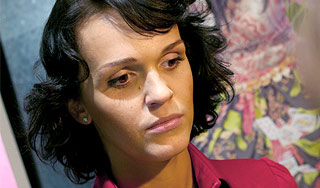 У певицы Славы проблемы с лицом У певицы Славы проблемы с лицом