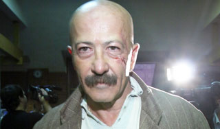 Розенбаум попал к врачам с ножевым ранением Розенбаум попал к врачам с ножевым ранением