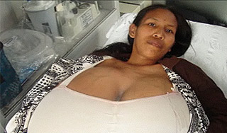 Женщина уменьшила грудь на 17 кг (фото) Женщина уменьшила грудь на 17 кг (фото)