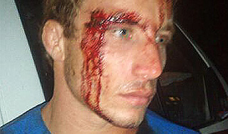 В детском лагере произошла массовая драка В детском лагере произошла массовая драка