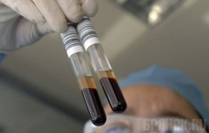 Брянцы чаще болели дизентерией, скарлатиной и СПИДом