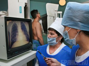 Число больных туберкулезом выросло на тысячу человек