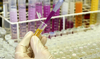 Ученые создали вакцину от СПИДа Ученые создали вакцину от СПИДа