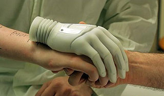 Добровольцу пришьют бионическую руку Добровольцу пришьют бионическую руку