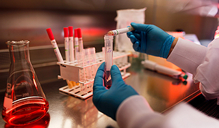 Опасную инфекцию везут из Европы в Россию Опасную инфекцию везут из Европы в Россию