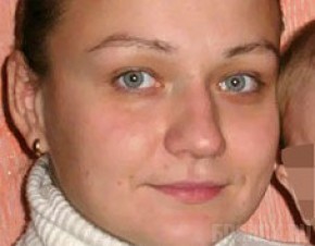 Анна Сивакова постепенно пошла на поправку