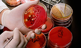 В Сибири повар заразился опасной инфекцией В Сибири повар заразился опасной инфекцией