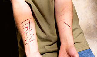 Десятки заключенных порезали себе вены Десятки заключенных порезали себе вены