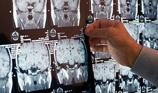 Интернет вызывает изменения в мозге Интернет вызывает изменения в мозге