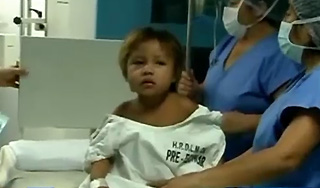 В теле трехлетнего ребенка нашли его брата В теле трехлетнего ребенка нашли его брата