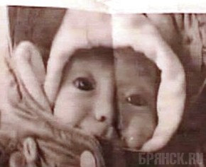 Горожане начали расклеивать объявления о пропаже Ани Шкапцовой