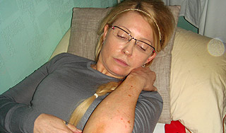 Тимошенко отказалась сдавать кровь немцам Тимошенко отказалась сдавать кровь немцам