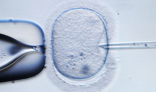 Врачи насчитали миллионы детей из пробирки Врачи насчитали миллионы детей из пробирки