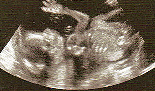 Эмбрионы могут наделить правами человека Эмбрионы могут наделить правами человека