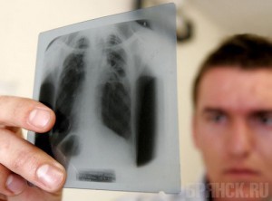 Больных туберкулезом отправили на принудительное лечение