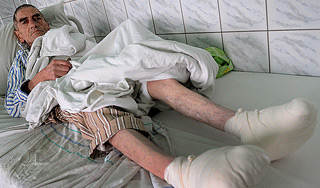 От морозов за сутки пострадали сотни людей От морозов за сутки пострадали сотни людей