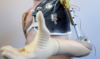 Мужчине вживили "руку Микеланджело" Мужчине вживили "руку Микеланджело"