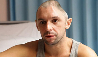 Британец в Таиланде лишился куска головы Британец в Таиланде лишился куска головы