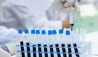 ВИЧ можно вылечить на ранней стадии ВИЧ можно вылечить на ранней стадии