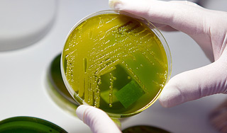 Бактерии избавят людей от лишнего веса Бактерии избавят людей от лишнего веса