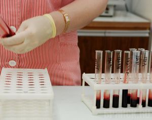 В 2012 году ВИЧ-инфекцию обнаружили почти у 200 брянцев