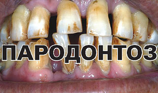 Курильщикам приготовили страшные фото Курильщикам приготовили страшные фото