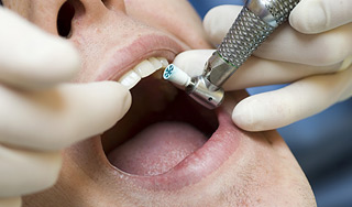 В Китае вырастили зуб из человеческой мочи В Китае вырастили зуб из человеческой мочи