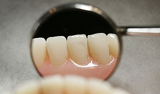 Ученые встроили в зуб датчик с Bluetooth Ученые встроили в зуб датчик с Bluetooth