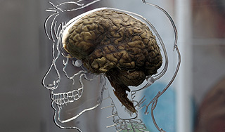 Ученые вырастили искусственный мозг Ученые вырастили искусственный мозг