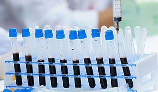 Человечеству грозят 320 тысяч новых вирусов Человечеству грозят 320 тысяч новых вирусов