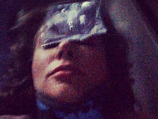 Фото Рынски со сломанным носом Фото Рынски со сломанным носом