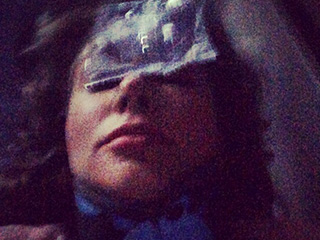 Фото Рынски со сломанным носом Фото Рынски со сломанным носом