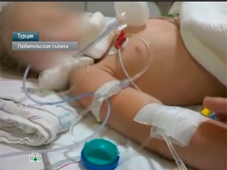 Мать пытается вернуть из Турции дочь в коме Мать пытается вернуть из Турции дочь в коме