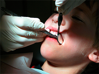 В Индии дантисты удалили подростку 232 зуба В Индии дантисты удалили подростку 232 зуба