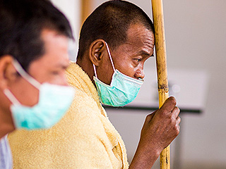 Малярию научились распознавать по лицу Малярию научились распознавать по лицу