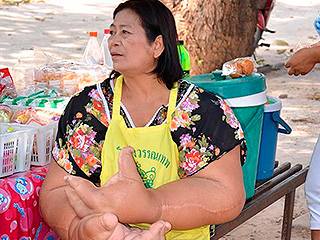 Женщина отказалась отрезать огромные руки Женщина отказалась отрезать огромные руки