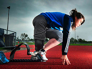 Британка просит отрезать ей вторую ногу Британка просит отрезать ей вторую ногу