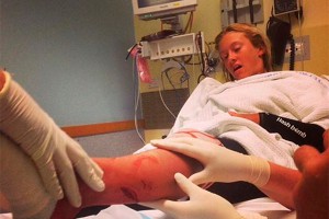 Девочка отбилась от акулы криком Девочка отбилась от акулы криком