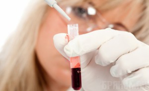 У 40 тысяч брянцев выявлен сахарный диабет