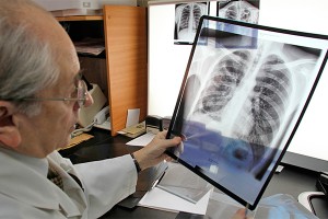 В СПбГУ отменили занятия из-за туберкулеза В СПбГУ отменили занятия из-за туберкулеза