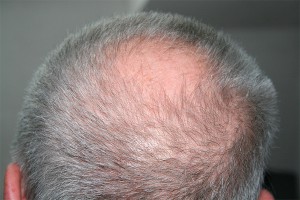 Полицейских вылечат от облысения и морщин Полицейских вылечат от облысения и морщин