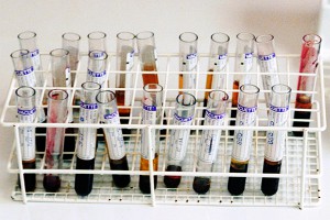 России грозит необратимая эпидемия ВИЧ России грозит необратимая эпидемия ВИЧ